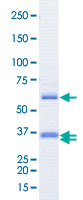Loading 1 &mu;g protein in SDS-PAGE